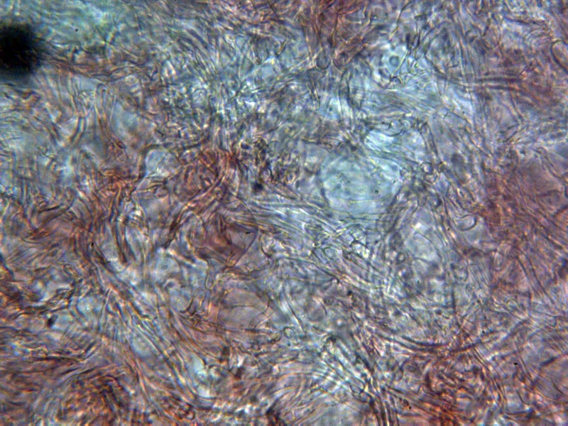 Amanita caesarea 15 - Hifas volva x 400